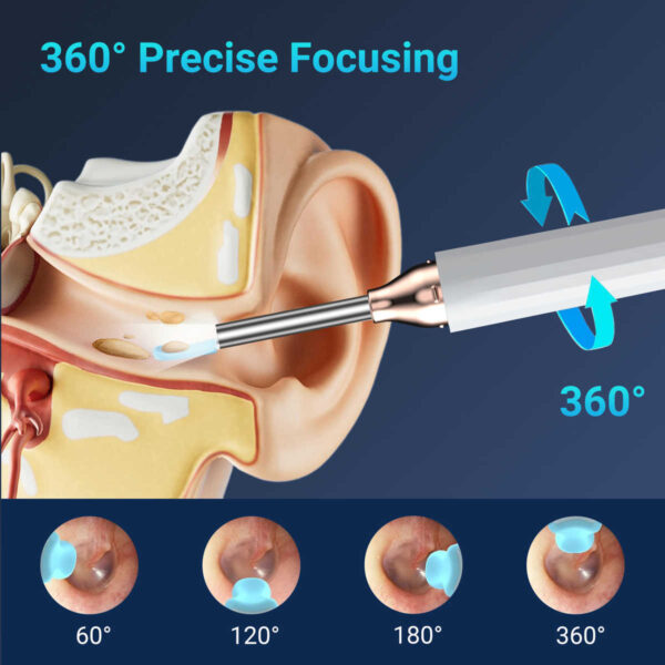 Nettoyage d'oreille Endoscope Enlèvement de la cire – Image 2
