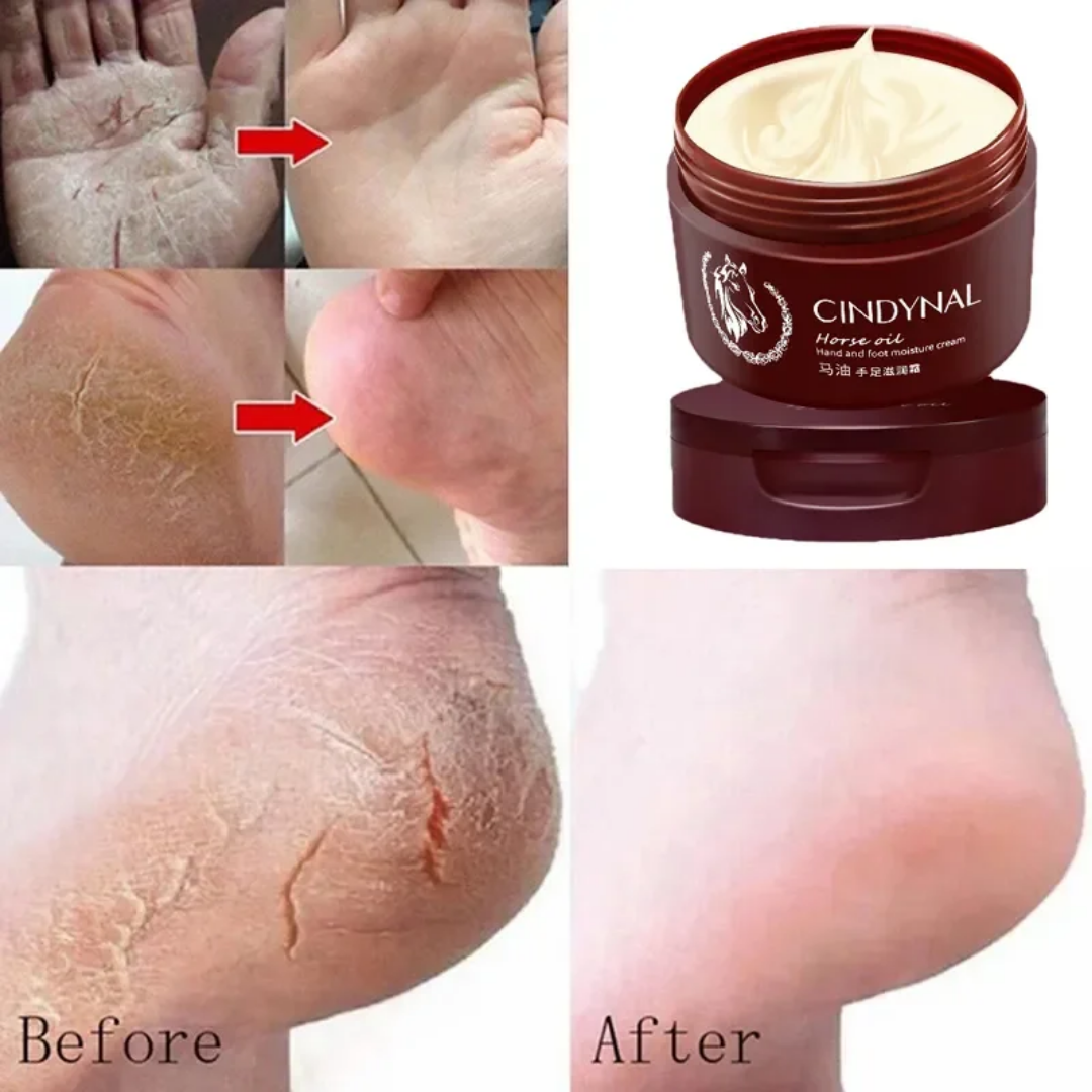 CINDYNAL Horse Oil – Crème hydratante mains & pieds – Image 3