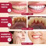 Pâte dentifrice ELAIMEI SP-4 Ultra+ Whitening